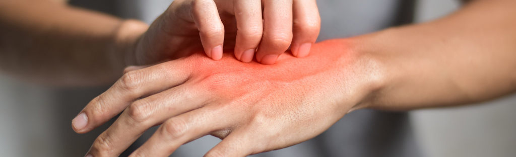 Removing Pepper Spray from Skin: Quick Relief Tips